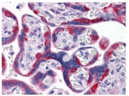 AM06299SU-N - PEG10