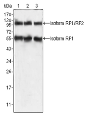 AM06299SU-N - PEG10