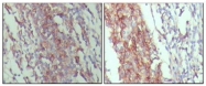 AM06301SU-N - CD45 / LCA