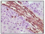 AM06304SU-N - Vimentin