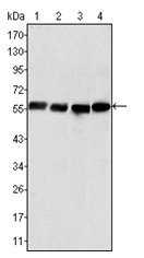 AM06304SU-N - Vimentin
