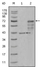 AM06305SU-N - Chitinase 1