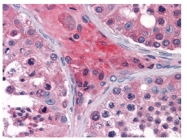 AM06315SU-N - Apolipoprotein O / Apo O