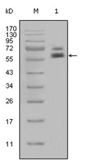 AM06316SU-N - Cytokeratin 5