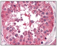 AM06317SU-N - B-Raf proto-oncogene