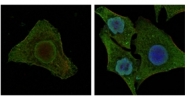 AM06317SU-N - B-Raf proto-oncogene