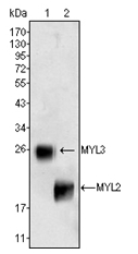 AM06318SU-N - Myosin light chain 2 (MYL2)