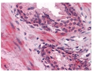 AM06323SU-N - Lipocalin-1