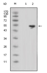AM06323SU-N - Lipocalin-1