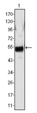 AM06339SU-N - Fibrinogen beta chain