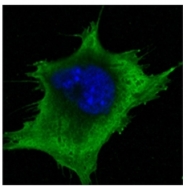 AM06340SU-N - Superoxide Dismutase 1 / SOD1