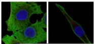 AM06340SU-N - Superoxide Dismutase 1 / SOD1