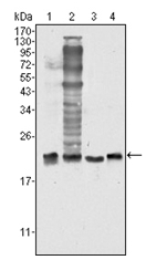 AM06340SU-N - Superoxide Dismutase 1 / SOD1
