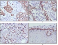 AM06354SU-N - Cytokeratin 17