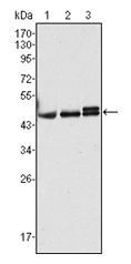 AM06354SU-N - Cytokeratin 17