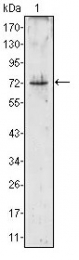AM06358PU-N - PR3 / C-ANCA