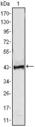 AM06380SU-N - ATP2C1