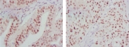 AM06380SU-N - ATP2C1