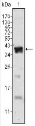 AM06392SU-N - Androgen receptor