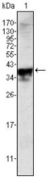 AM06392SU-N - Androgen receptor