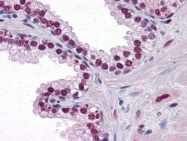 AM06392SU-N - Androgen receptor