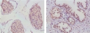 AM06392SU-N - Androgen receptor