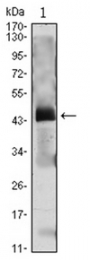 AM06422SU-N - Parathyroid hormone / PTH