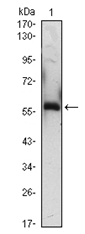AM06423SU-N - Alpha-1B-glycoprotein / A1BG
