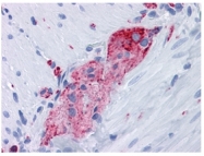 AM06430SU-N - Synaptophysin / SYP