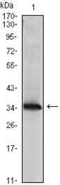 AM06451SU-N - NDP kinase A