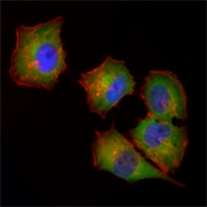 AM06451SU-N - NDP kinase A