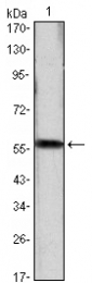 AM06463SU-N - Cyclin D1
