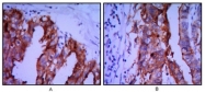 AM06465SU-N - Alkaline phosphatase / PLAP / ALPP