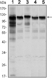AM06493SU-N - Hexokinase-1