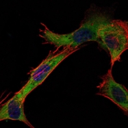 AM06493SU-N - Hexokinase-1