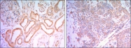 AM06493SU-N - Hexokinase-1