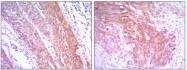 AM06497SU-N - Hexokinase-2