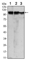 AM06497SU-N - Hexokinase-2