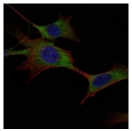 AM06498SU-N - Hexokinase-1