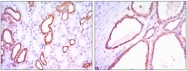 AM06498SU-N - Hexokinase-1