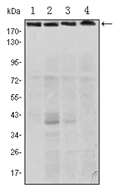 AM06502SU-N - RICTOR