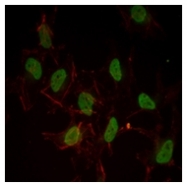AM06510SU-N - Estrogen receptor alpha