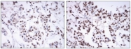 AM06510SU-N - Estrogen receptor alpha