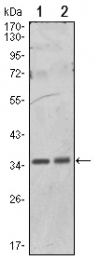 AM06514SU-N - PPP1CA
