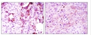 AM06550SU-N - Osteoprotegerin / TNFRSF11B
