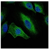 AM06572SU-N - Aurora kinase A