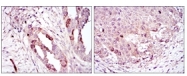 AM06573SU-N - Aurora kinase A