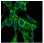 AM06574SU-N - ACTA2 / aortic smooth muscle Actin