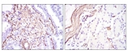 AM06575SU-N - ACTA2 / aortic smooth muscle Actin