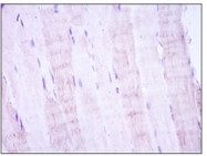 AM06580SU-N - MAP2K4